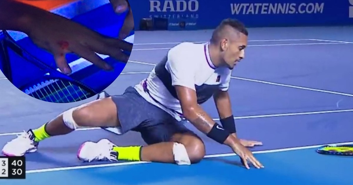 Kyrgios urlao na suca i publiku: "Ruke mi krvare, koji vam je k*rac?"